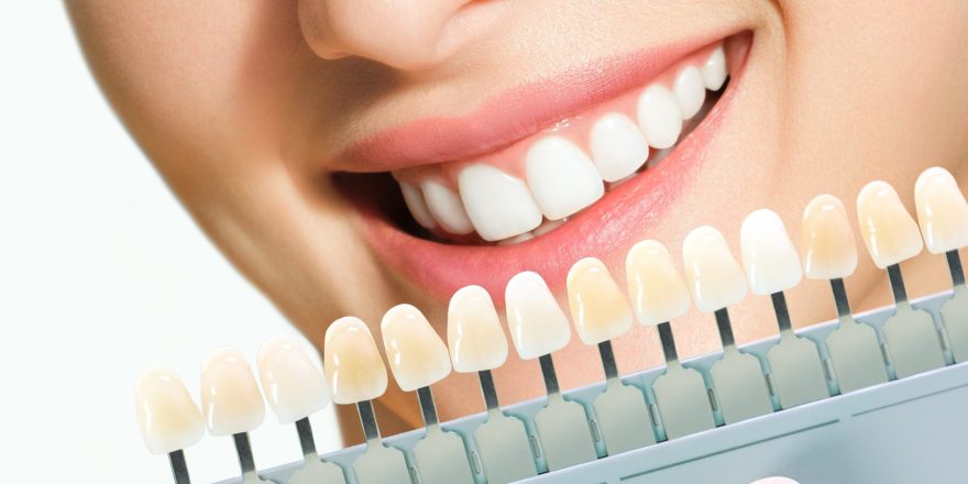 smiling-young-woman-cosmetological-teeth-whitening-dental-clinic-selection-tone-implant-tooth-min