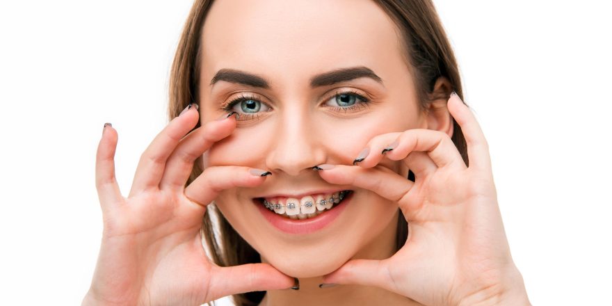 beautiful-young-woman-with-teeth-braces-min